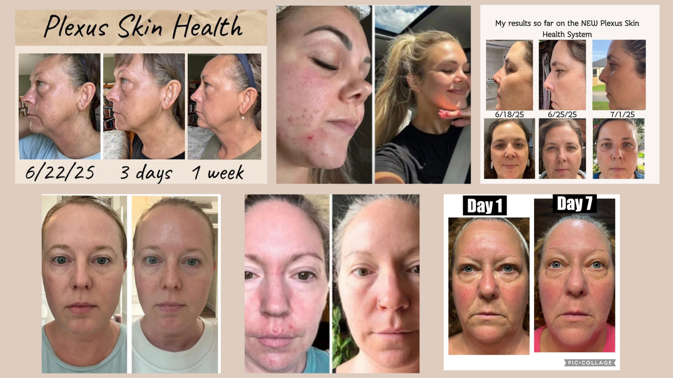 Skin Health System before and after results 3